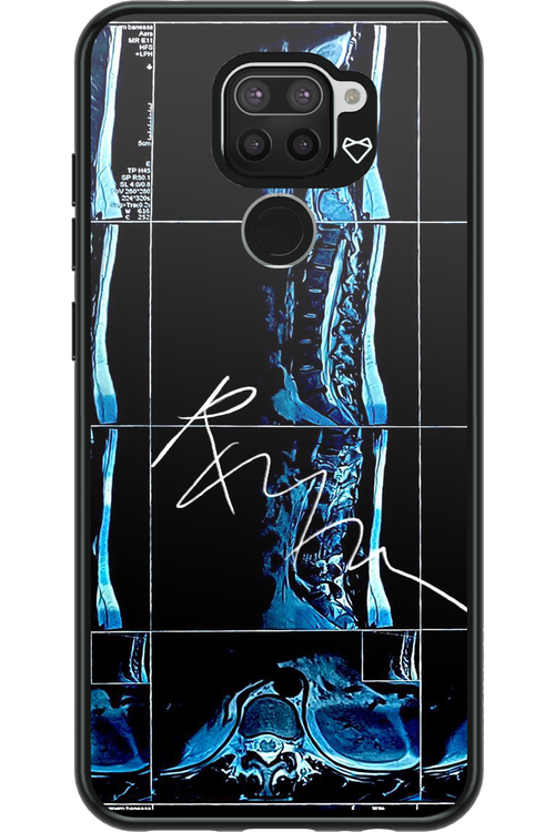 RMN Scolioza 2.0 - Xiaomi Redmi Note 9