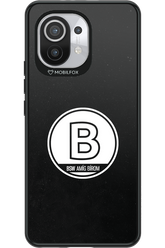 Amig bírom Black - Xiaomi Mi 11 5G