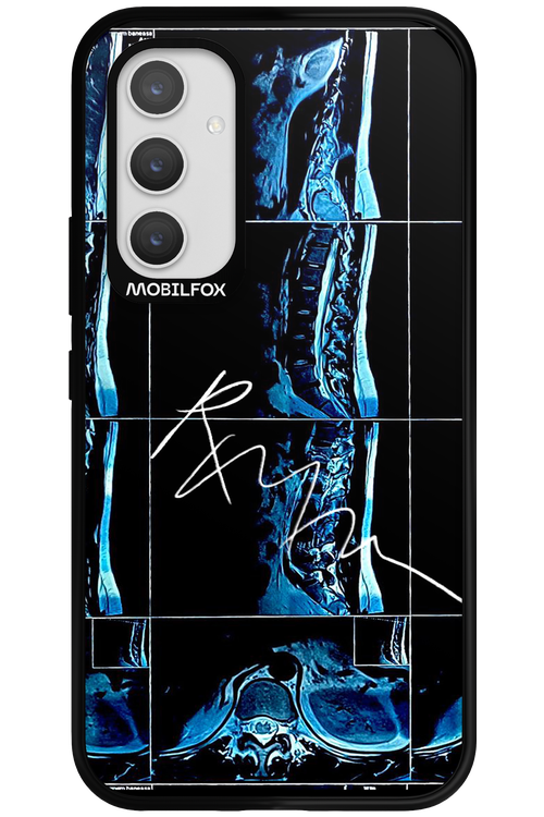 RMN Scolioza - Samsung Galaxy A54