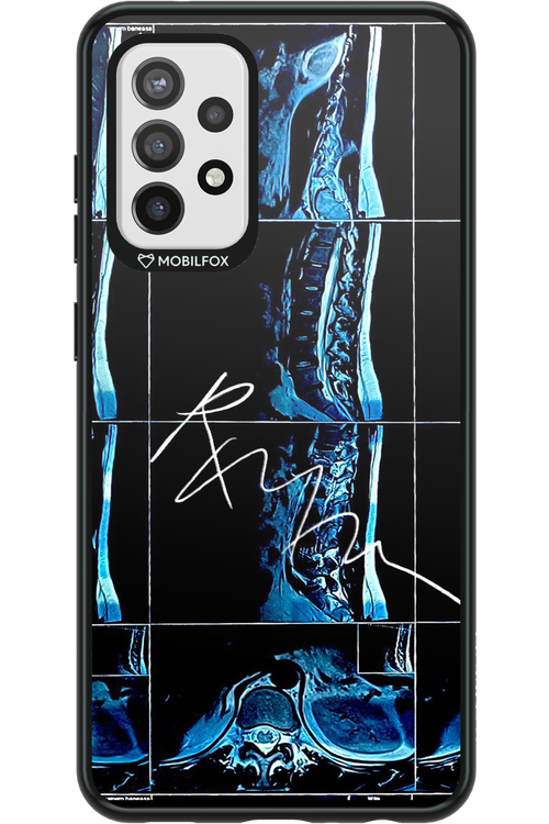 RMN Scolioza 2.0 - Samsung Galaxy A72