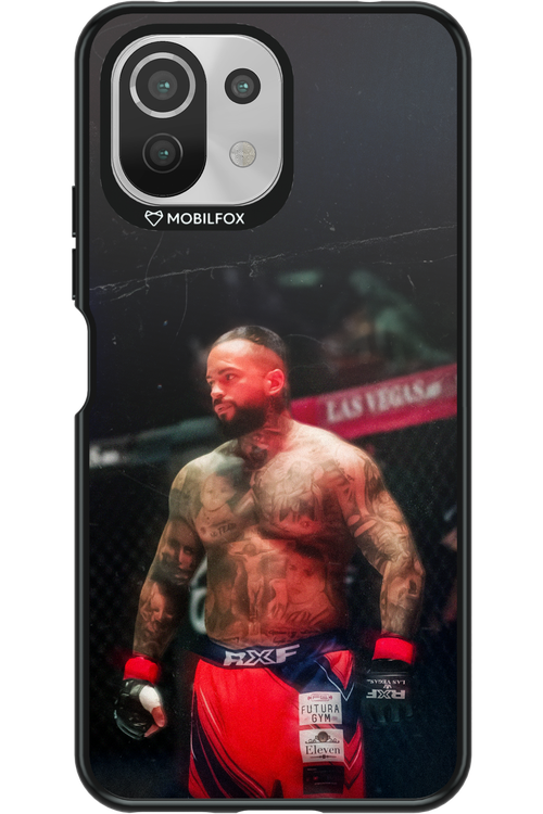 Unstoppable - Xiaomi Mi 11 Lite (2021)