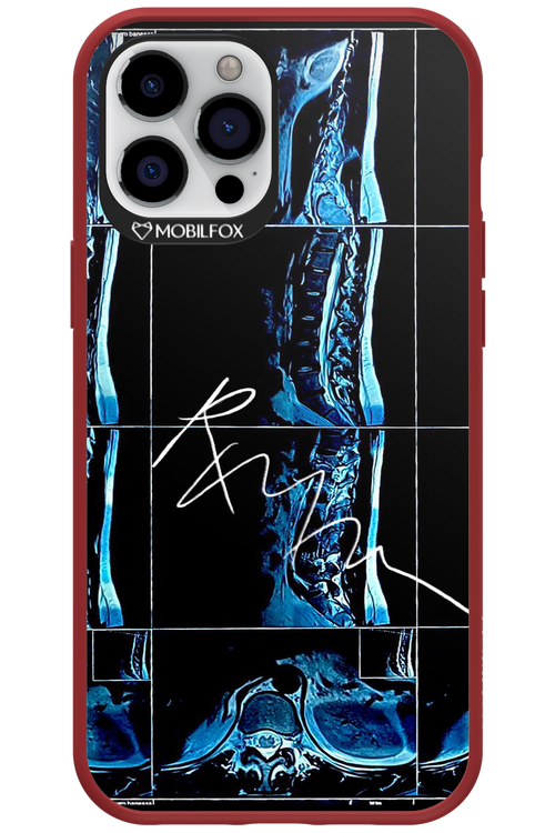 RMN Scolioza 2.0 - Apple iPhone 12 Pro Max