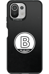 Amig bírom Black - Xiaomi Mi 11 Lite (2021)