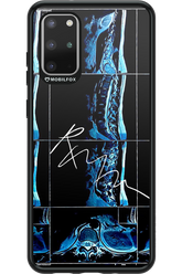 RMN Scolioza 2.0 - Samsung Galaxy S20+