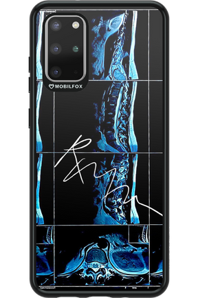 RMN Scolioza 2.0 - Samsung Galaxy S20+
