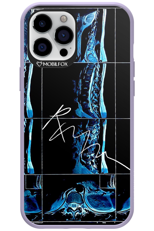 RMN Scolioza 2.0 - Apple iPhone 12 Pro Max
