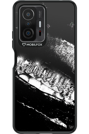 Grillz Black Centaur 2.0 - Xiaomi Mi 11T Pro