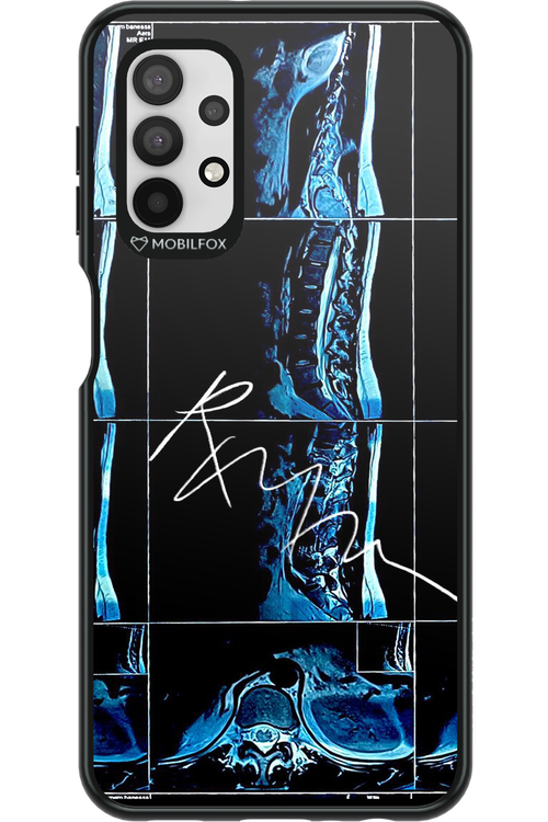 RMN Scolioza 2.0 - Samsung Galaxy A32 5G