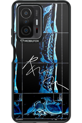 RMN Scolioza 2.0 - Xiaomi Mi 11T Pro