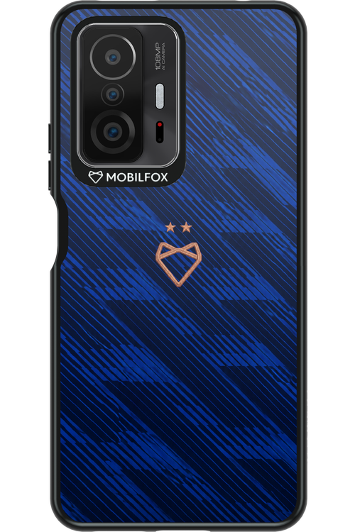 Franta 2.0 x Mobilfox 2.0 - Xiaomi Mi 11T