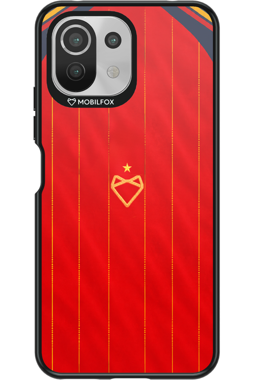 Spain 2.0 x Mobilfox 2.0 - Xiaomi Mi 11 Lite (2021)