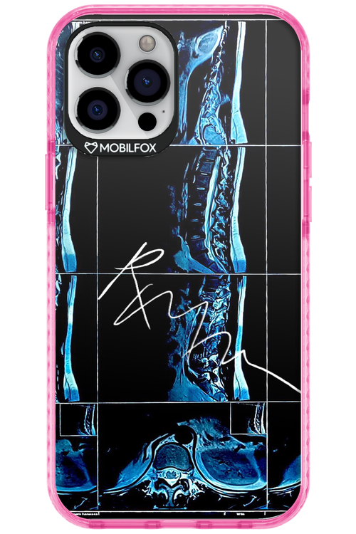 RMN Scolioza 2.0 - Apple iPhone 12 Pro Max