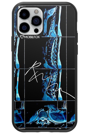 RMN Scolioza 2.0 - Apple iPhone 12 Pro