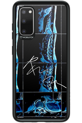 RMN Scolioza 2.0 - Samsung Galaxy S20