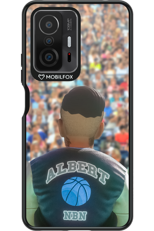Albert 2.0 - Xiaomi Mi 11T