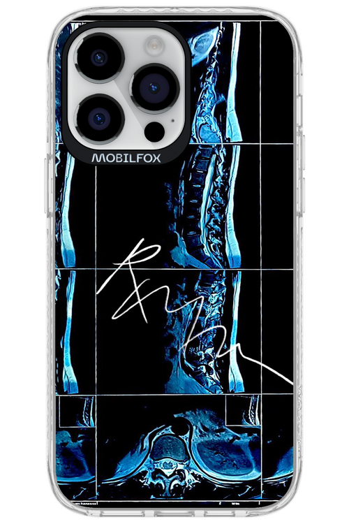 RMN Scolioza 2.0 - Apple iPhone 14 Pro Max