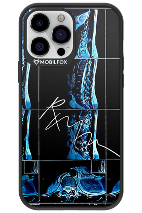 RMN Scolioza 2.0 - Apple iPhone 13 Pro Max