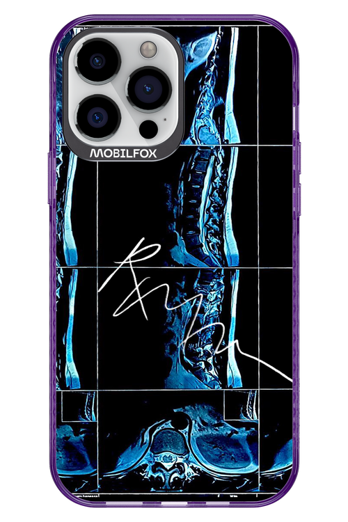 RMN Scolioza 2.0 - Apple iPhone 13 Pro Max