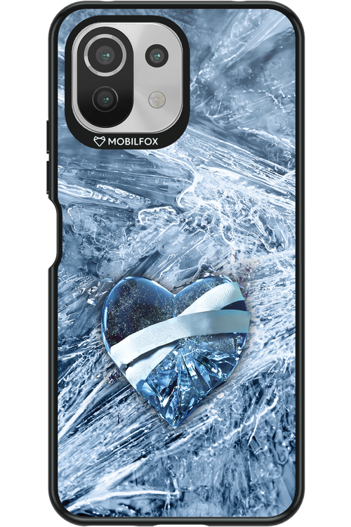 Ice 2.0 - Xiaomi Mi 11 Lite (2021)