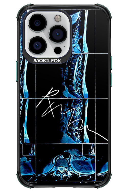 RMN Scolioza 2.0 - Apple iPhone 13 Pro