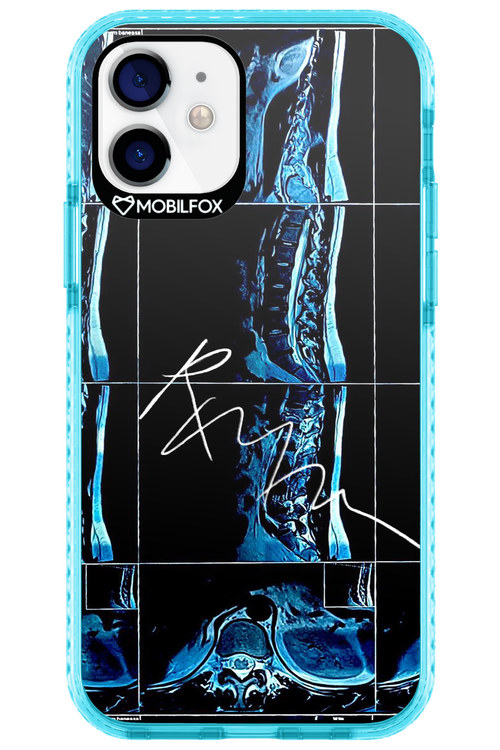 RMN Scolioza 2.0 - Apple iPhone 12