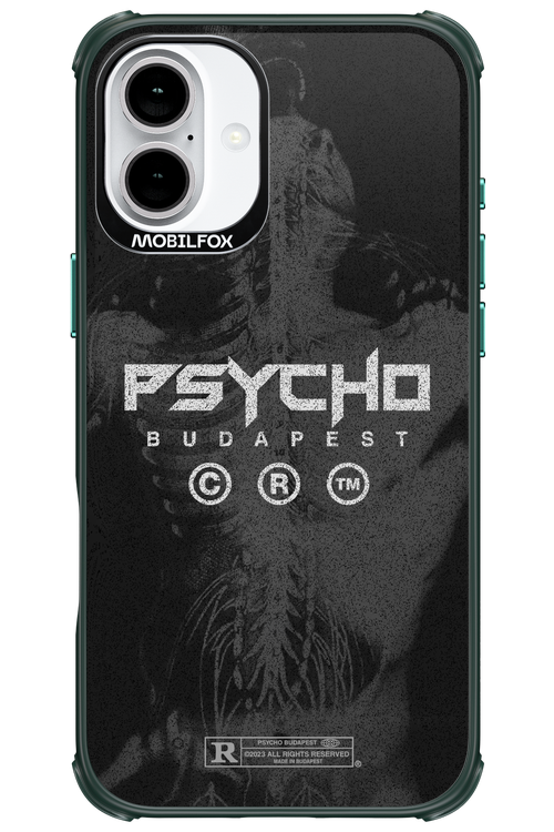 X-Ray - Apple iPhone 16 Plus