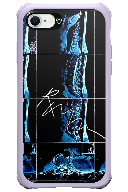 RMN Scolioza 2.0 - Apple iPhone 7