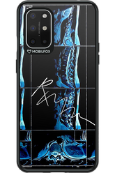 RMN Scolioza 2.0 - OnePlus 8T