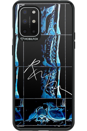 RMN Scolioza 2.0 - OnePlus 8T