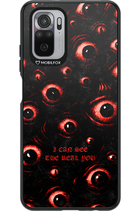 The Watchers - Xiaomi Redmi Note 10