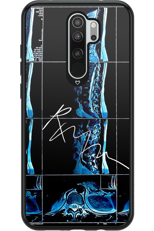 RMN Scolioza 2.0 - Xiaomi Redmi Note 8 Pro