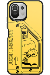 Crumple Zone 2.0 - Xiaomi Mi 11 Lite (2021)