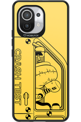 Crumple Zone 2.0 - Xiaomi Mi 11 5G