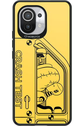 Crumple Zone 2.0 - Xiaomi Mi 11 5G