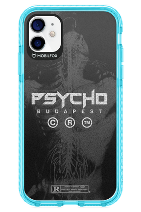 X-Ray - Apple iPhone 11