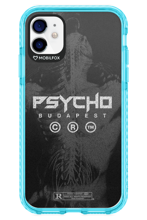 X-Ray - Apple iPhone 11