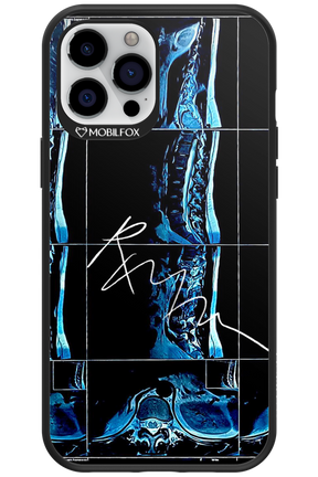 RMN Scolioza 2.0 - Apple iPhone 12 Pro Max