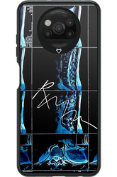 RMN Scolioza 2.0 - Xiaomi Poco X3 Pro