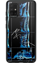 RMN Scolioza 2.0 - Samsung Galaxy A51