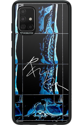 RMN Scolioza 2.0 - Samsung Galaxy A51