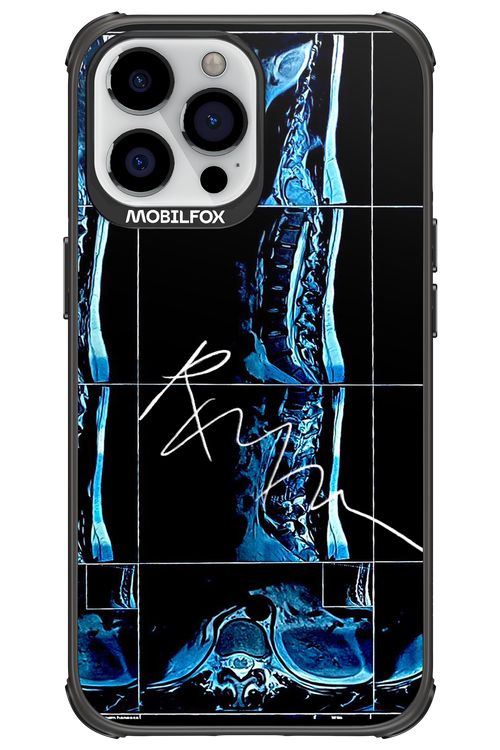 RMN Scolioza 2.0 - Apple iPhone 13 Pro Max