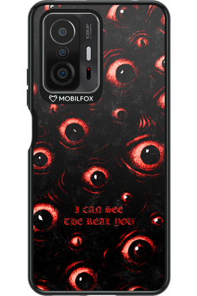 The Watchers - Xiaomi Mi 11T