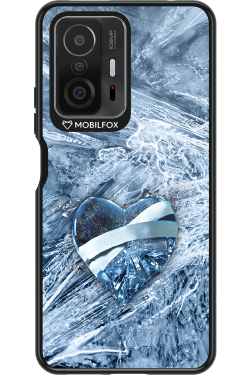 Ice 2.0 - Xiaomi Mi 11T