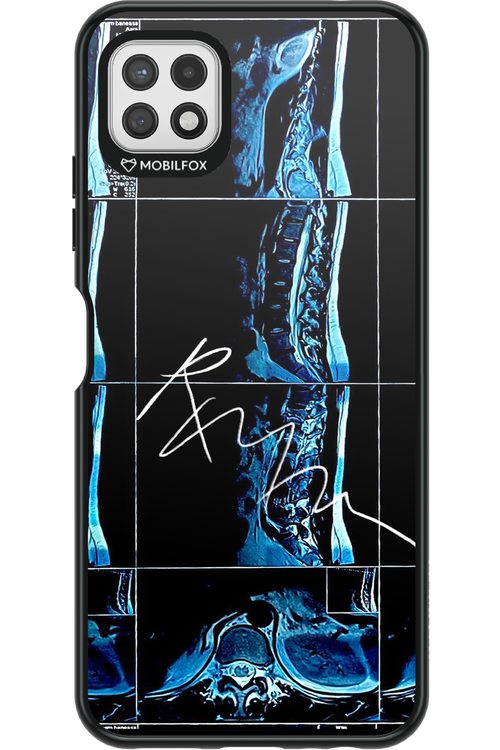RMN Scolioza 2.0 - Samsung Galaxy A22 5G