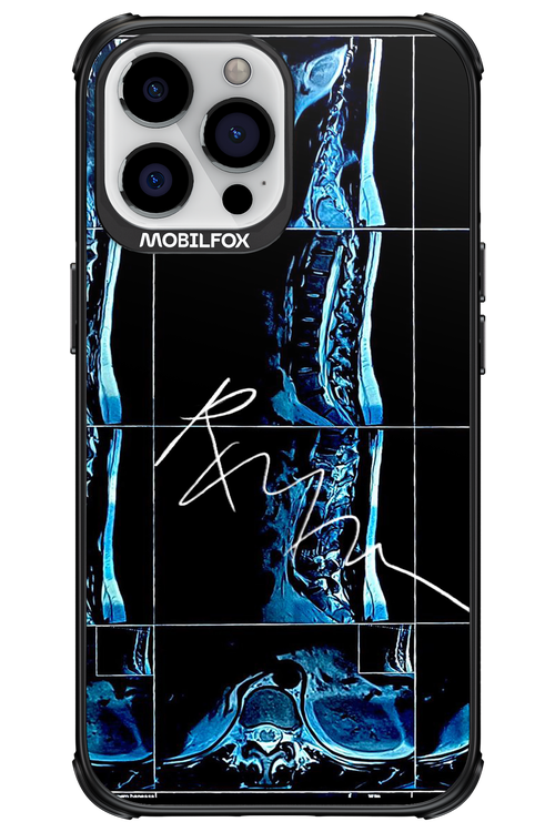 RMN Scolioza 2.0 - Apple iPhone 13 Pro Max