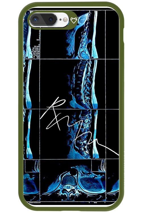RMN Scolioza 2.0 - Apple iPhone 8 Plus