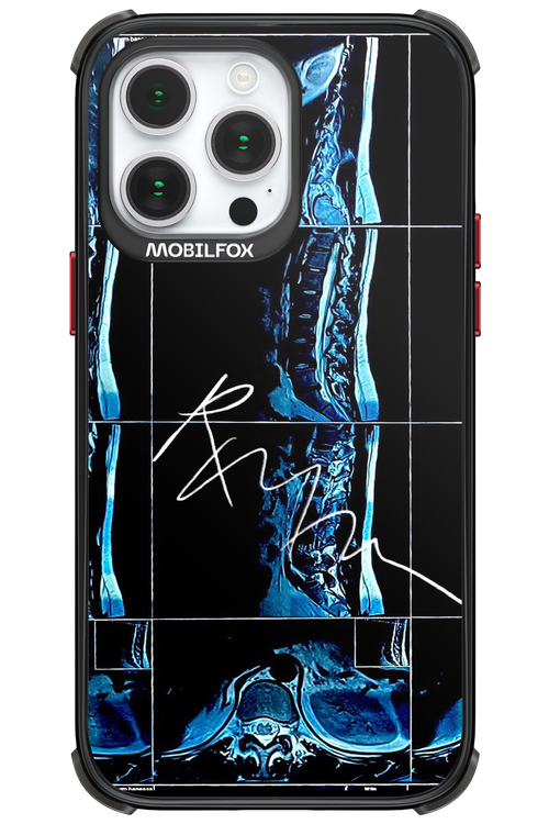 RMN Scolioza 2.0 - Apple iPhone 14 Pro Max