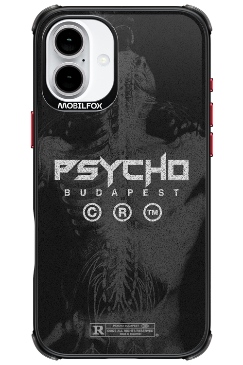 X-Ray - Apple iPhone 16 Plus
