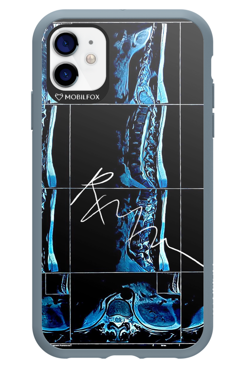 RMN Scolioza 2.0 - Apple iPhone 11