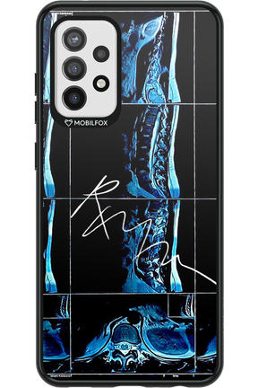 RMN Scolioza 2.0 - Samsung Galaxy A72